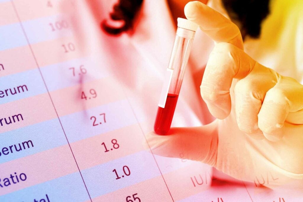 St. Joseph’s Hospital and the Rotary Club of Buckhannon-Upshur to hold summer blood screenings in June and July