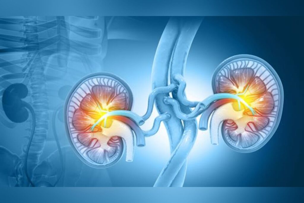 WVU Medicine outlines key signs, treatment and prevention for kidney stones