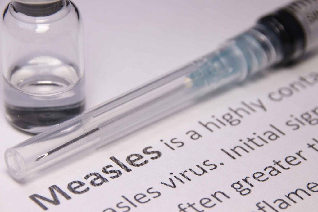 Health officials confirm measles case in unvaccinated Barbour County resident